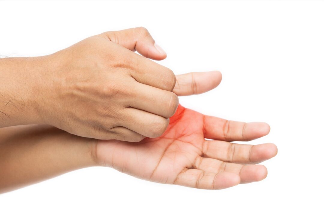 Itching with a fungus and its treatment with zxcvbnmqwert cream with cream