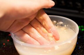 Nail fungus