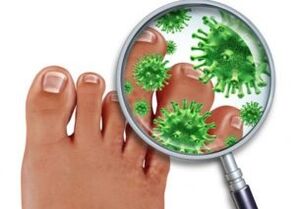 methods to treat toenail fungus