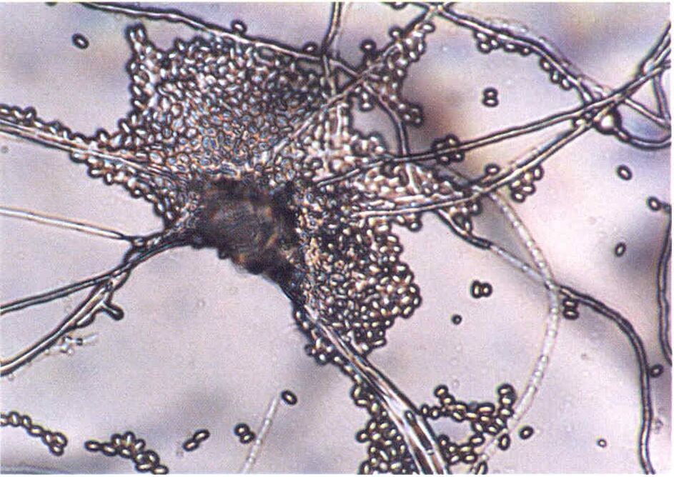 View of the fungus under a microscope.